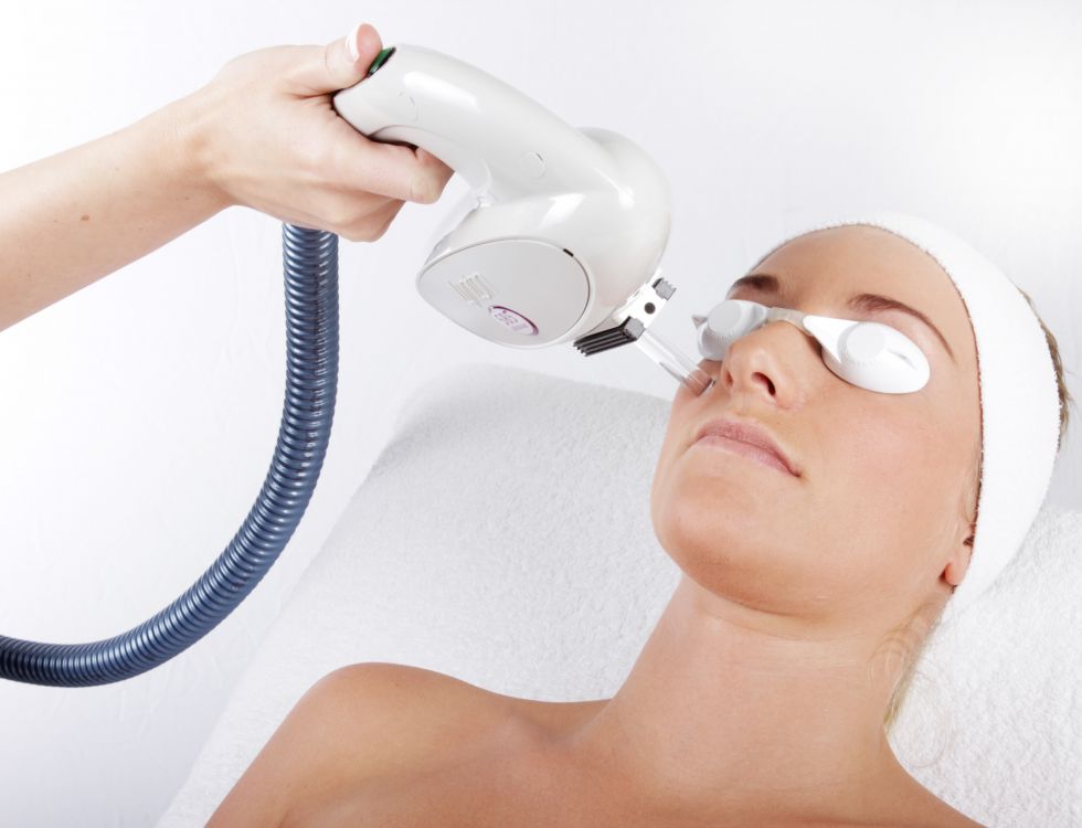 Laser IPL