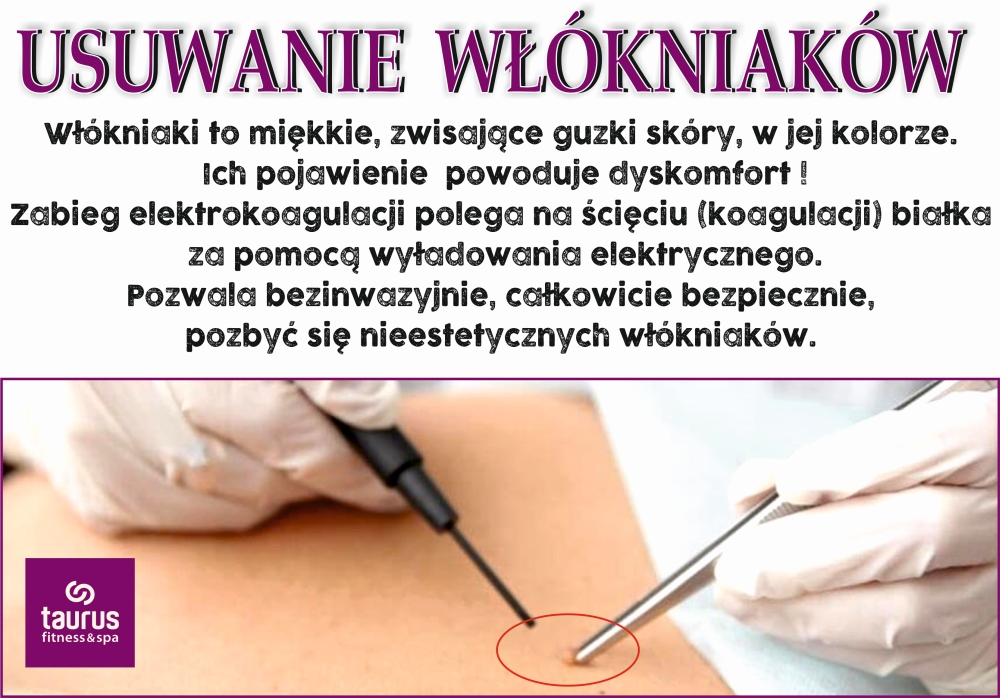 KOAGULACJA - NOWE URZĄDZENIE