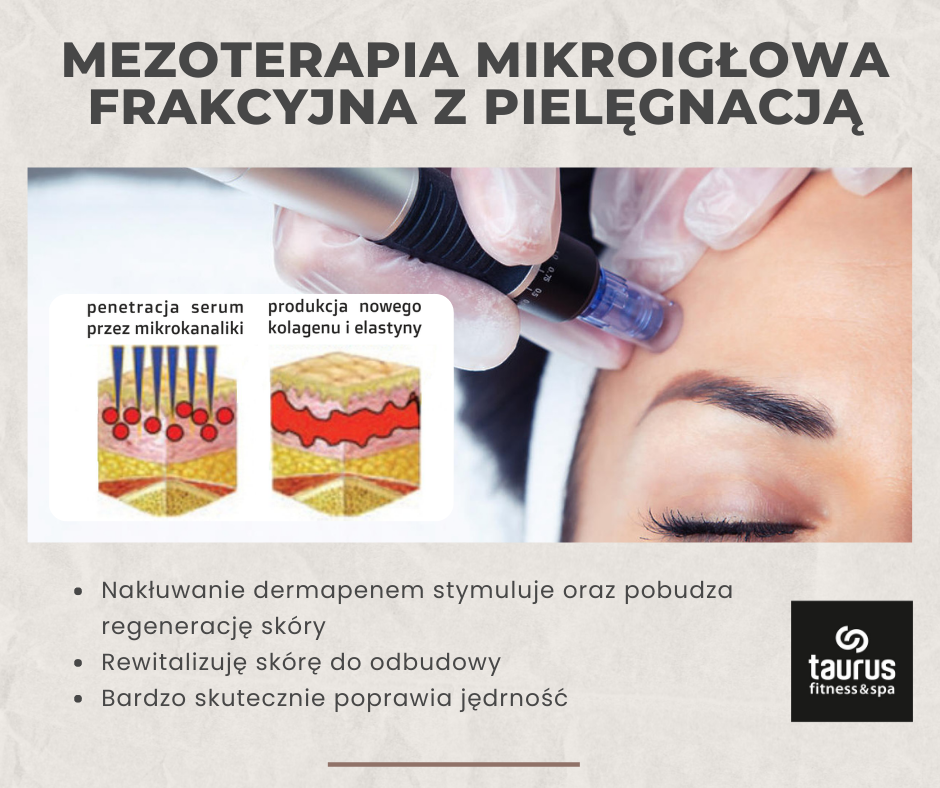 MEZOTERAPIA MIKROIGŁOWA FRAKCYJNA Z PIELĘGNACJĄ